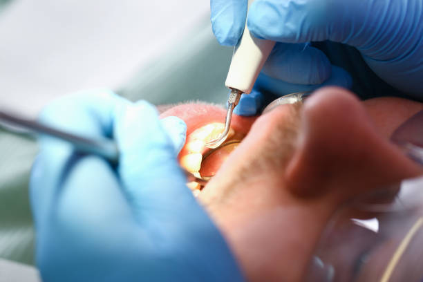 Best Emergency Orthodontic Repairs in Glennville, GA