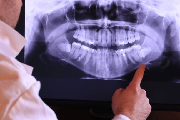 Best Walk-In Emergency Dentist in Glennville, GA