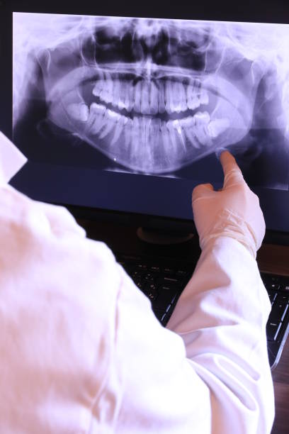 Best Emergency Broken Tooth Repair in Glennville, GA