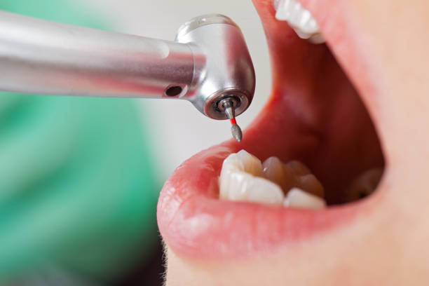 Best After-Hours Emergency Dentist in Glennville, GA